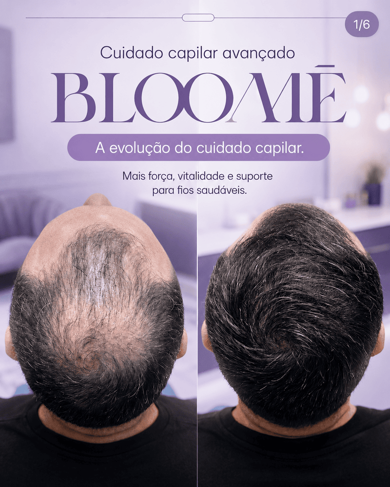Cuidado capilar avançado começa de dentro para fora. 💜